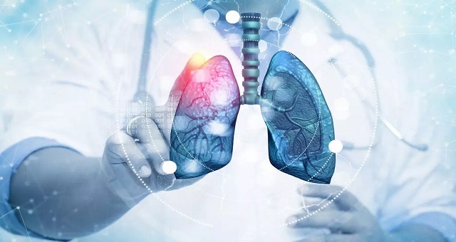 Médecine: Un nouvel outil pour combattre la récidive du cancer du poumon